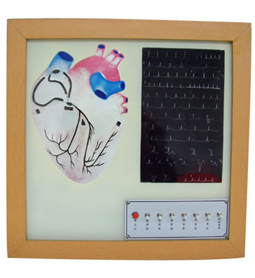 心臟傳導(dǎo)系電動模型 心臟傳導(dǎo)系電動模型